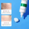 Bioaqua Salicylic Acid Acne Removal cream - Image 3