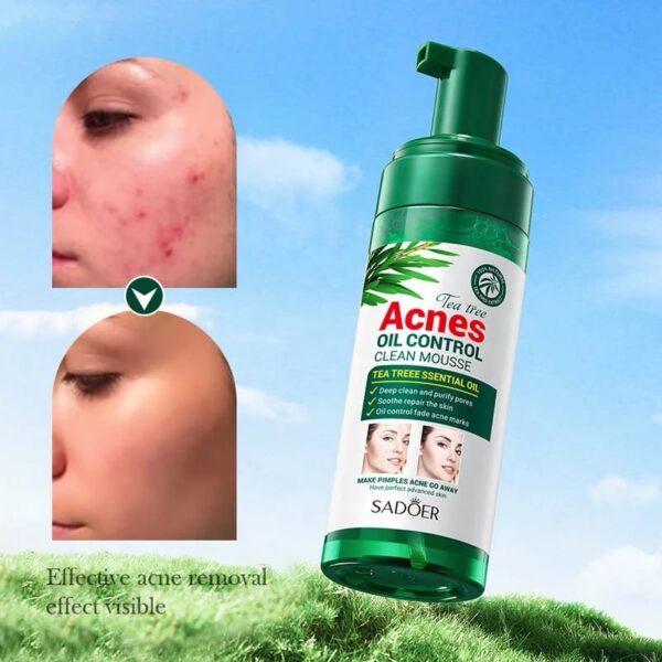 Sadoer Tea tree Anti-acne Mousse - Image 2